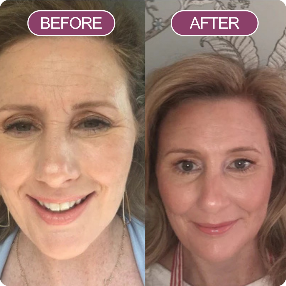 Glowvi Calcium Volume Eye Patch